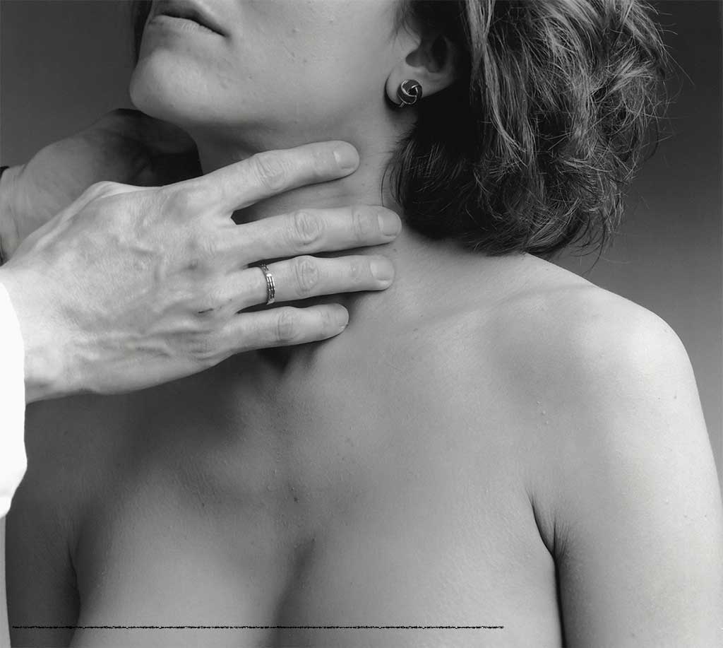 Ipotiroidismo: un disturbo ormonale e metabolico