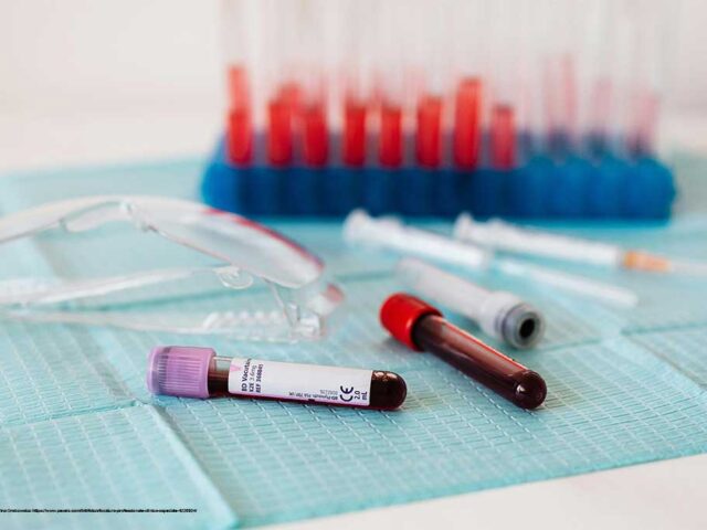 Analisi del sangue